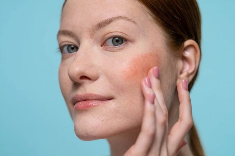 Oral JAK inhibitors vs biologics: the current landscape in atopic dermatitis